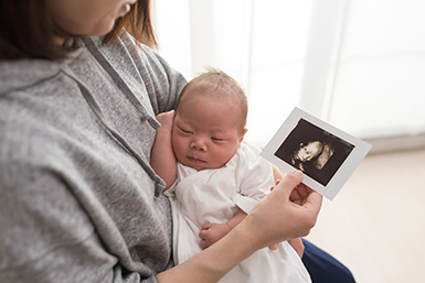 エコー写真が消える前に! 正しい保管・保存の仕方とは